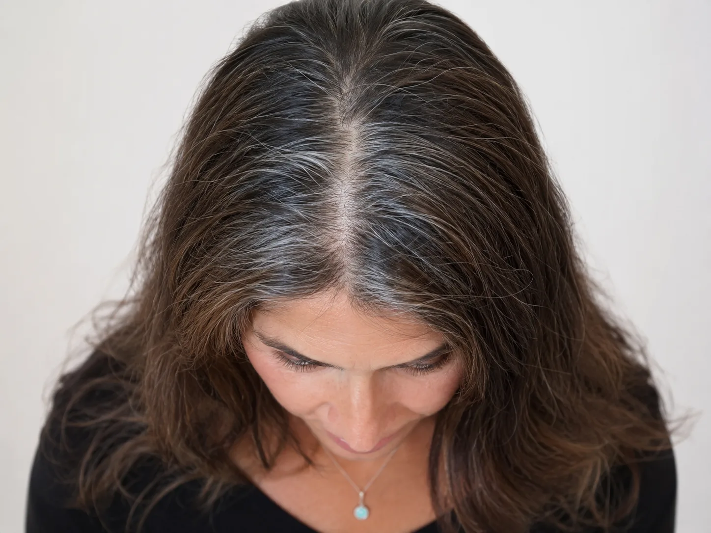 Fios brancos aparecendo na raiz do cabelo